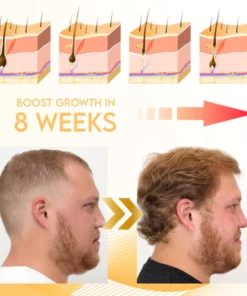 Luxonix Hair Nutrition Regrowth Spray