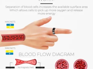 LymphDrainage SlimFit MagneticTherapy Ring