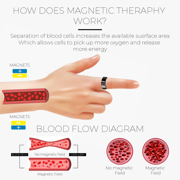 LimphDrainage SlimFit MagneticTherapy žiedas