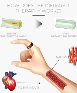 LymphDrainage SlimFit MagneticTherapy Ring