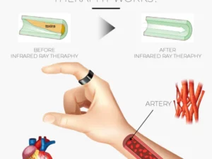 LymphDrainage SlimFit MagneticTherapy Ring