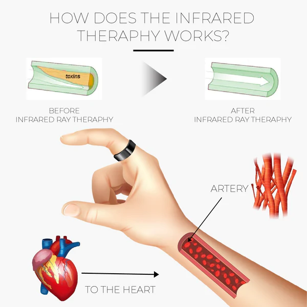 Lymphdrainage SlimFit MagneticTherapy Ring