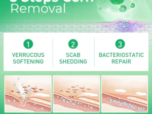 MEDix™ Active Corn Remover