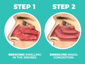 MEDix™ Japanese Nasal Congestion Relief Spray