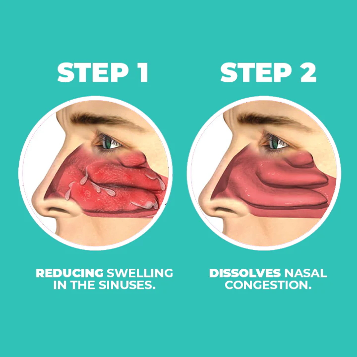 MEDix™ Japanese Nasal Congestion Relief Spray