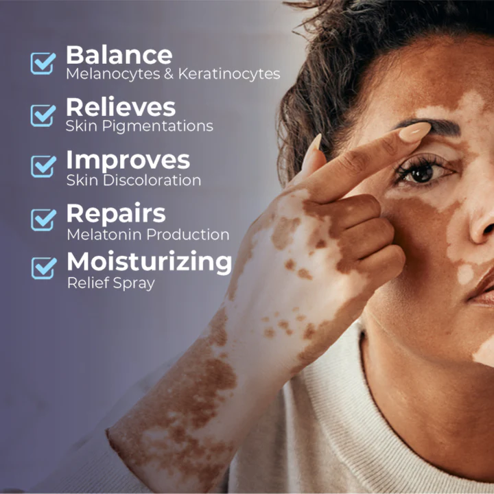 MEDix™ Vitiligo Relief Spray