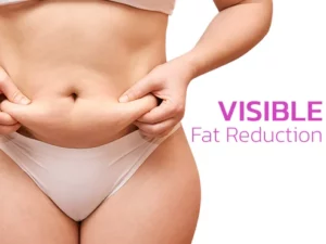 MYMI CurveBelly Wonder Patch
