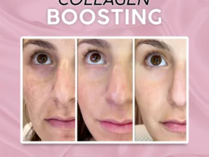 Magic Anti-Wrinkle Eye Cream