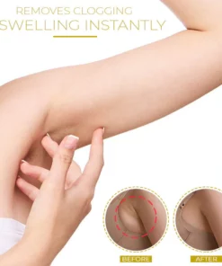 Magnetic LymphDetox SlimmingRing