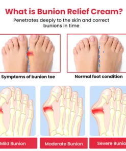 Medifix Bunions Relief Cream