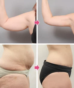 MeltsPlus FatBurner EssentialOil