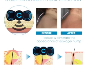 Microcurrent FastRelief Lymphvity NeckMassager