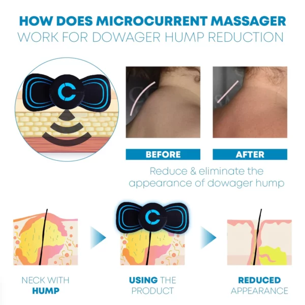 Microcurrent FastRelief Lymphvity Neck Massager