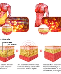 Moovings® PRO Tummy Control Body Shaper Shorts