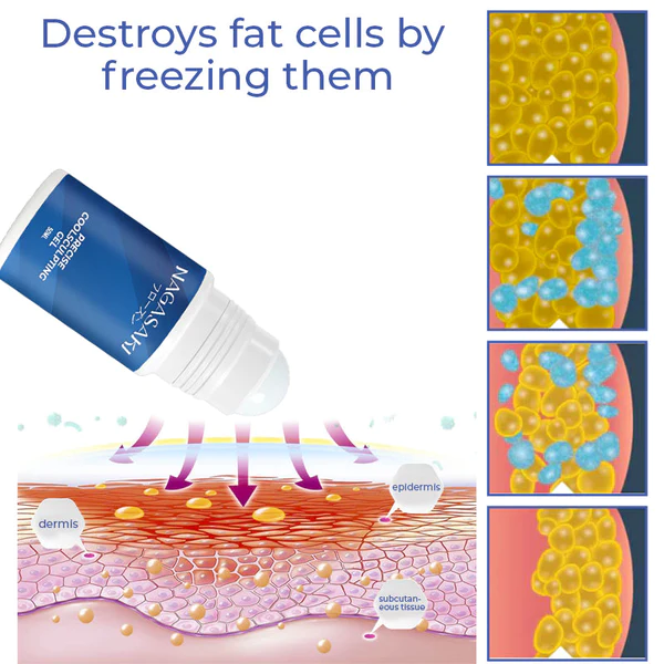 Gel CoolSculpting Tepat Nagasaki DermoFreeze™