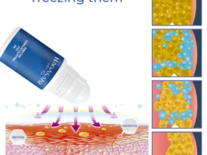 Nagasaki DermoFreeze™ Precise CoolSculpting Gel