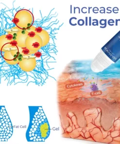 Nagasakiフローズン Precise CoolSculpting Gel