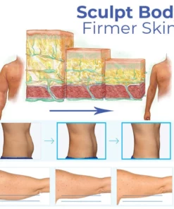 Nagasakiフローズン Precise CoolSculpting Gel