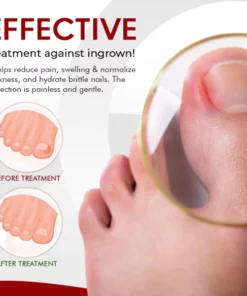 NailCare™ Ingrown Relief Oil