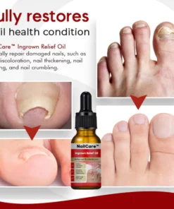 NailCare™ Ingrown Relief Oil