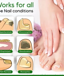 NailCare™ Toe Nail Treatment Gel