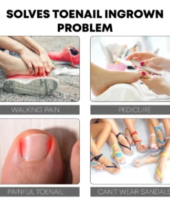 NailRelief AntiParonychia Herbal Oil