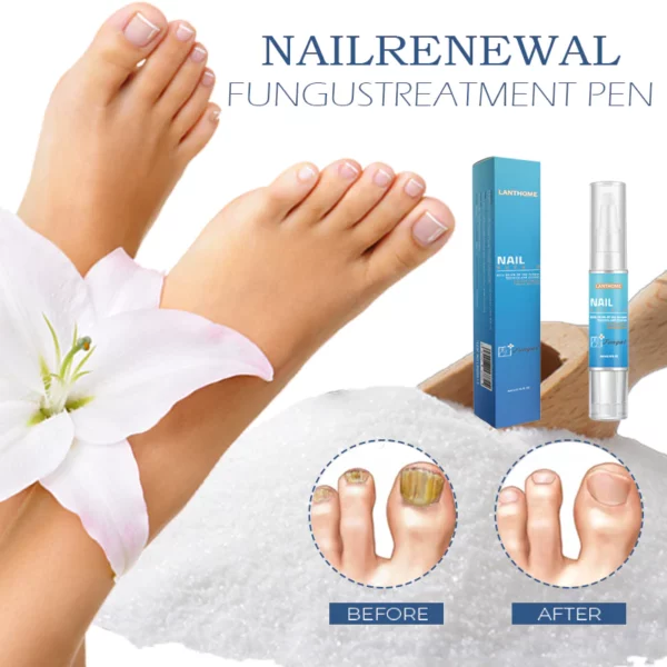 NailRenewal FungusTreatment Penna