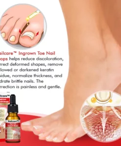 Nailcare™ Ingrown Toe Nail Drops