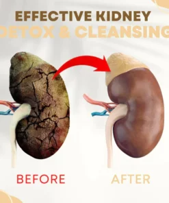 NatureCleanse™ Kidney Support Herbal Effervescent Tablets