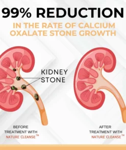 NatureCleanse™ Kidney Support Herbal Effervescent Tablets