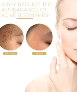 Nauraille™ Phyto Corrective Soothing Fluid