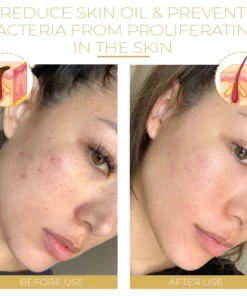 Nauraille™ Phyto Corrective Soothing Fluid