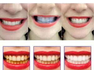 New PROPOLIS TeethRegrowth Dental Gel