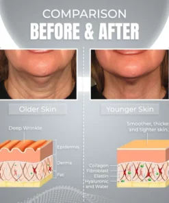 NuBeautyPlus V-Face Beauty Device