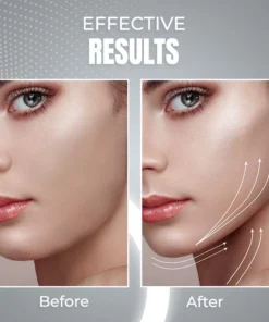 NuBeautyPlus V-Face Beauty Device