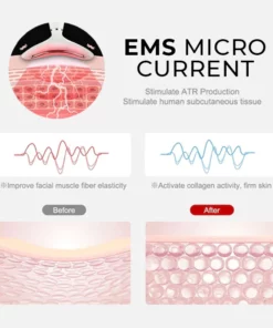 OSUFI™ Revolution-V Face Shaper