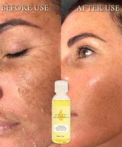Oilex™ Natural Spots Whitening Yellow Peeling Oil