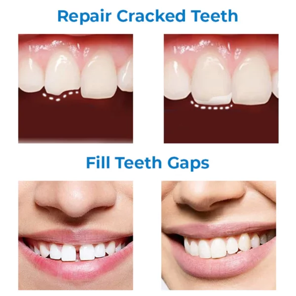 OraClean Tooth Repair Shaping ชุดยางกัด