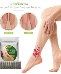 POP-Youth™ Anti-Edema VaricoseVeinCare TreatmentFootSoak