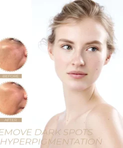 POP-Youth™ Spot-OFF DarkSpot Removal Serum