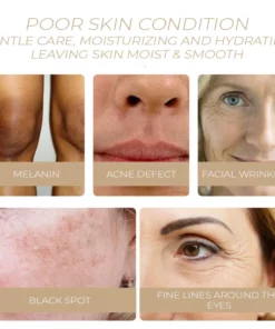 POP-Youth™ Spot-OFF DarkSpot Removal Serum