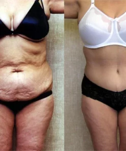 PROBeautyLady™ Collagen Lifting Body Oil