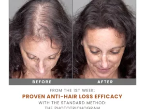 PURA Hair Reborn Biotin Shampoo