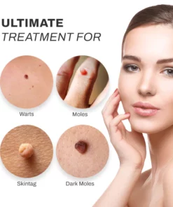 PUREOrganic WartRemover Cream