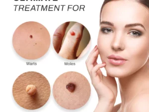 PUREOrganic WartRemover Cream