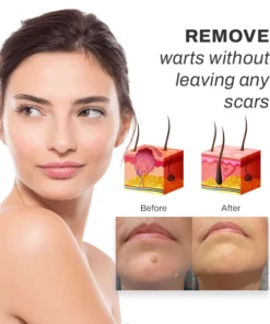 PUREOrganic WartRemover Cream