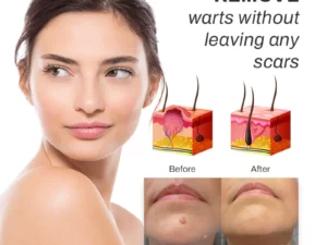 PUREOrganic WartRemover Cream