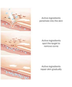 PUREOrganic WartRemover Cream