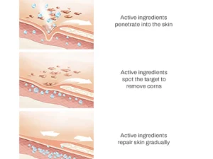 PUREOrganic WartRemover Cream