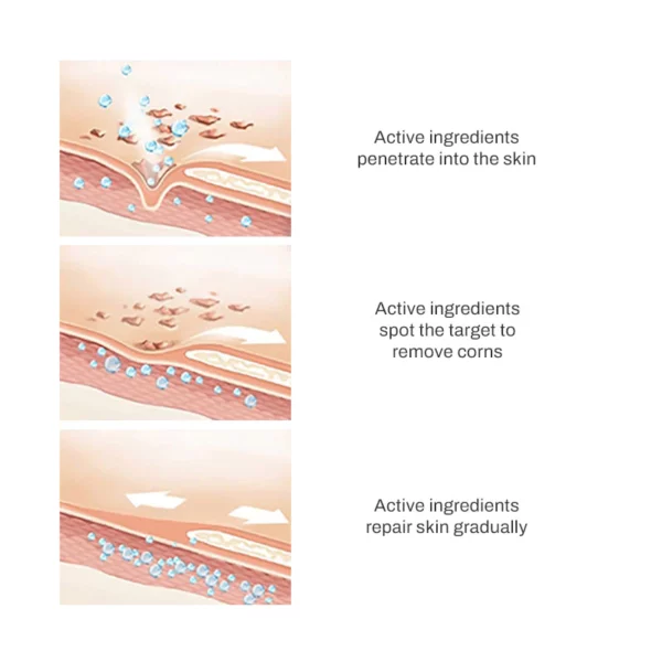 PURECrema Eliminadora de Verrugas Orgánica